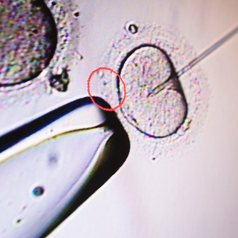 In Vitro Fertilization at New England Fertility